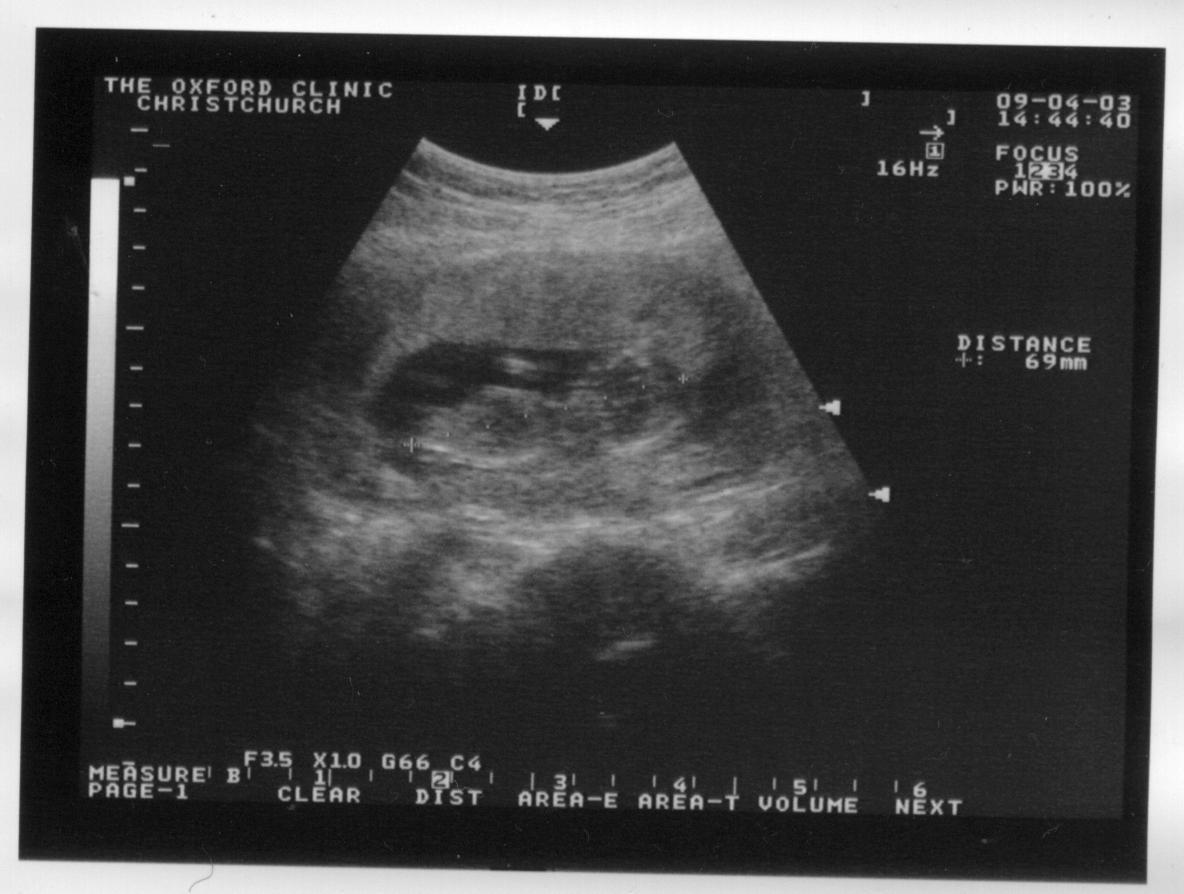 Baby/2003-00/2003-04-09_scan1_OxfordClinic.jpg