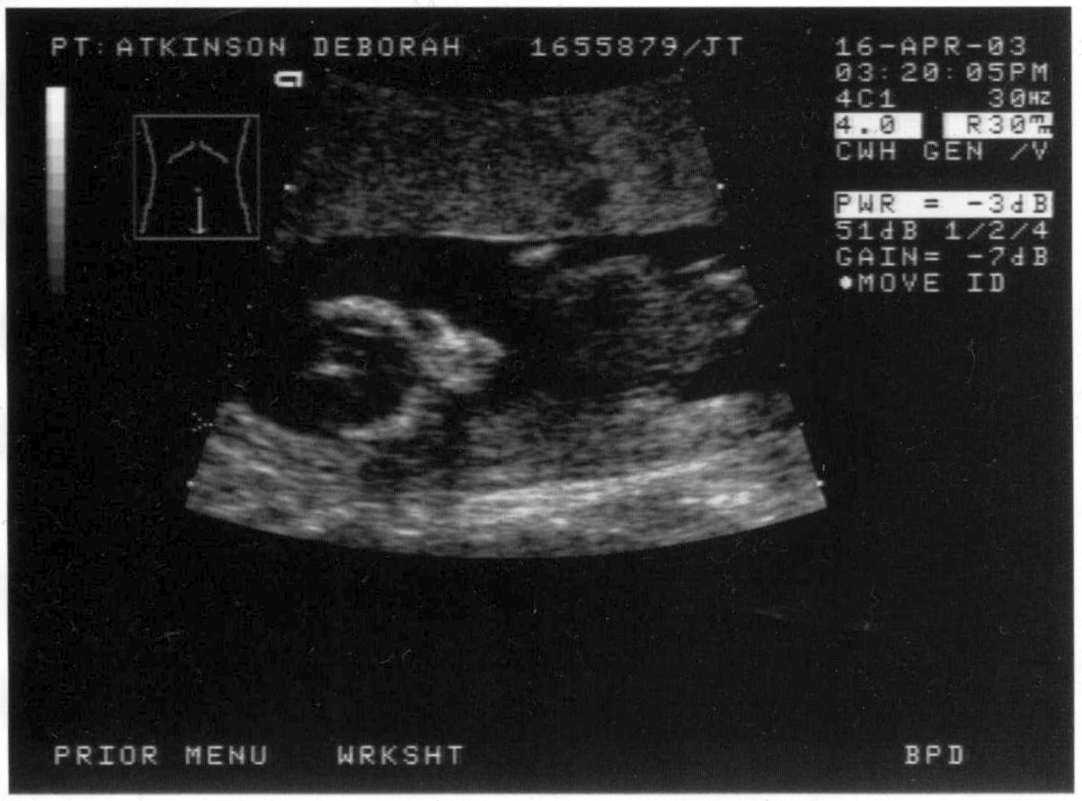 Baby/2003-00/2003-04-16_scan3_Chch_Womans.jpg